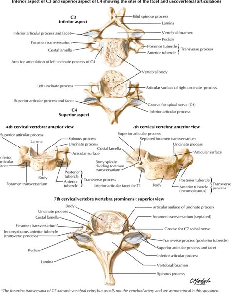 Unstable Cervical Spine Fractures — NUEM Blog