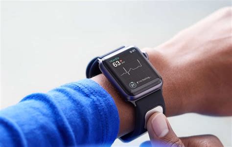 Apple Watch band detects dangerous potassium levels without drawing blood