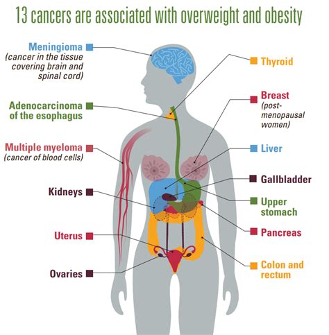 Cancer and Obesity: How to Reduce Your Risk – Eat Smart, Move More ...