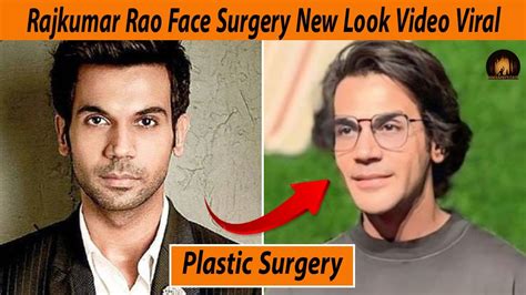 Rajkumar Rao Face Surgery New Look Viral, Public Shocking Reaction #rajkumarrao #plasticsurgery ...