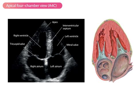 Standard Transthoracic Echocardiogram: Complete Imaging Protocol – Cardiovascular Education