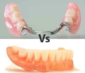 The difference in acrylic (plastic) vs. metal (Cobalt Chrome) dentures ...