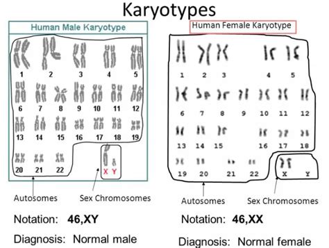 Karyotyping Procedure - Uses, Examples, Protocol (Video), Results ...