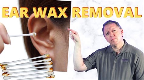 Can Ear Wax Build Up Hurt at Abigail Cole blog