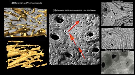 a Haversian canals at the center of osteons are interconnected by ...