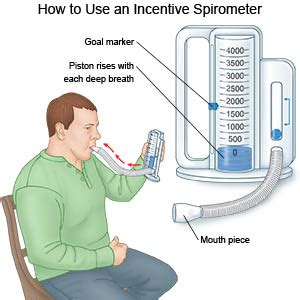 How To Use An Incentive Spirometer - What you need to know in 2020 ...