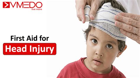 Know These First Aid Steps For Head Injury - VMEDO Blog