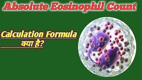 37+ absolute eosinophil count calculator