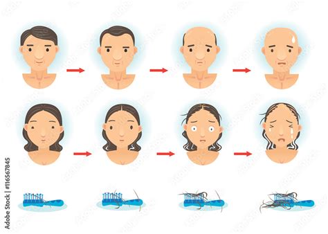 Hair Loss/The process of hair loss. Cartoon vector illustration Stock Vector | Adobe Stock