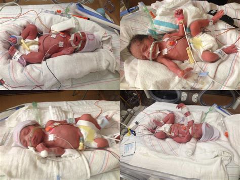 Father Cares for Quadruplets After Mother Dies in Childbirth | Time