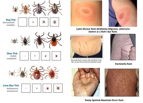 Can All Ticks Cause Lyme Disease at Kimberly Herrera blog