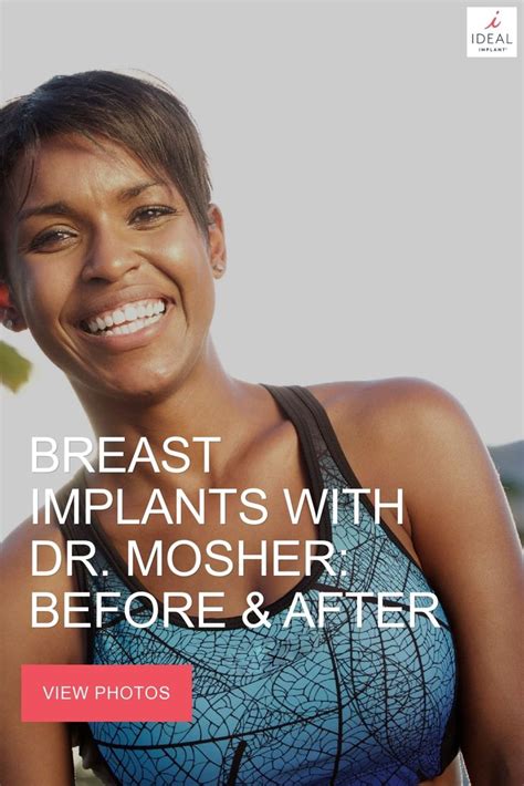 Breast Implants: Before and After with Dr. Mosher | Implants breast ...