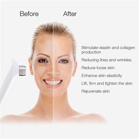 Be the first to review “MLAY RF Radio Frequency Facial And Body Skin ...