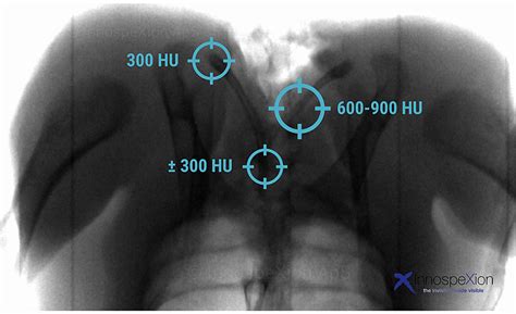 Standardize sample chicken bones used for x-ray testing | 2020-01-15 | The National Provisioner