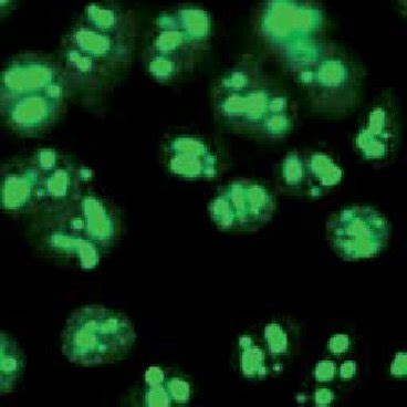 Example of nucleolar pattern of ANA detected by indirect... | Download Scientific Diagram