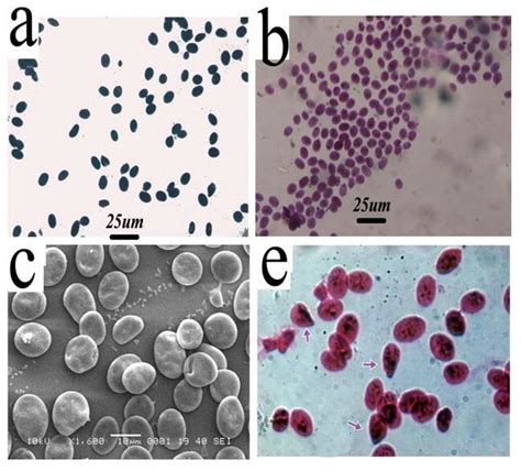 (a) All types of Anadara antiquata blood cells are Sudan Black B... | Download Scientific Diagram