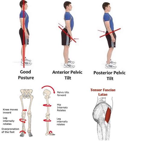 Tensor Fasciae Latae Exercises