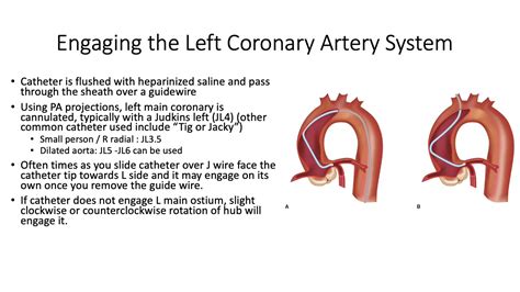 Left Heart Catheterization - an introduction. - YouTube