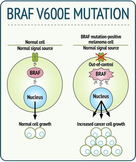 BRAF Geni Mutasyonu | BRAF gene mutation | Bronzlaşma