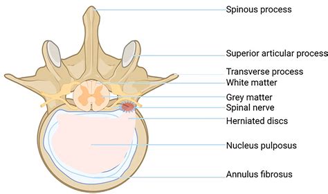 Frontiers | The role of oxidative stress in intervertebral disc cellular senescence