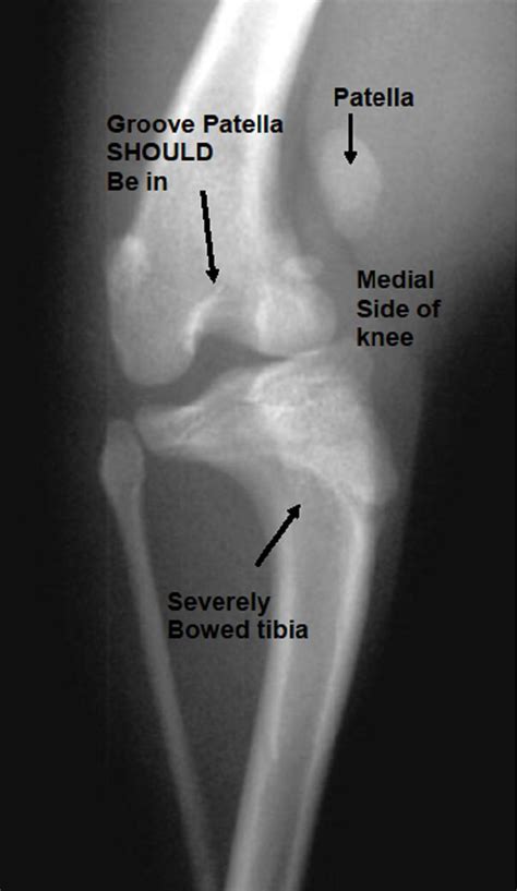 Medial Luxating Patella: Grades of Dislocations, Surgery and Treatments - Western Suburbs ...