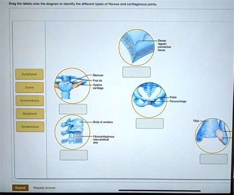 SOLVED: Drag the labels onto the diagram to identify the different types of fibrous and ...