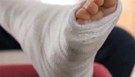 Ankle Surgery Procedure Description | MyMediTravel Knowledge