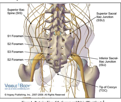 Figure 1 from A Study of the Sacral Anatomy and Its Implications on the ...