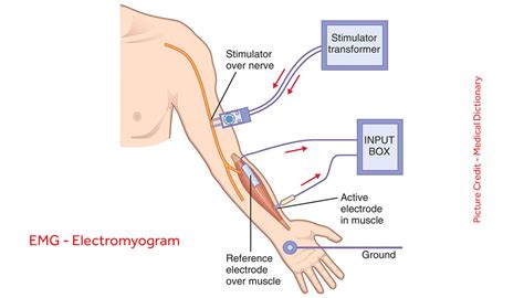 What is Electromyogram - Atyutka General Knowledge