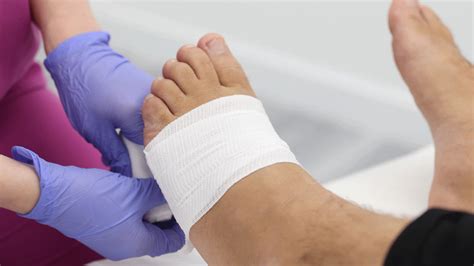 Tailor's Bunion Surgery Recovery Time: 5 Powerful Tips