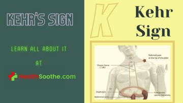 Kehr's Sign | What You Need To Know About It (with Pictures And Videos)