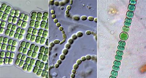 Phylum Chlorophyta Under Microscope