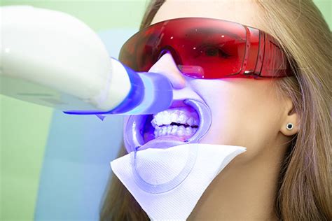 Laser Teeth Whitening and Possible Effects on Gums