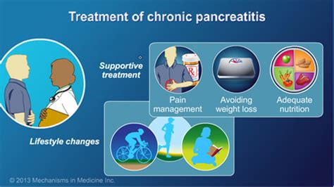 Slide Show - Management and Treatment of Chronic Pancreatitis