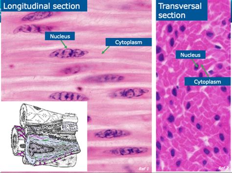 muscle, tendon and ligament histology Flashcards | Quizlet