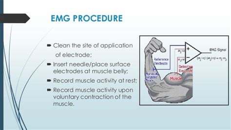 Electromyogram