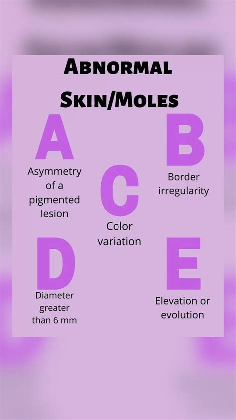 Nursing Student Cheat Sheet, Integumentary System, Anatomy, Moles, Skin abnormal, ABCDE rule in ...