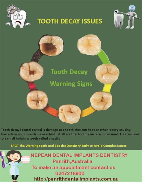 What is Tooth Decay? Sign of tooth decay problem!!!! Look at this infographics #dentist # ...