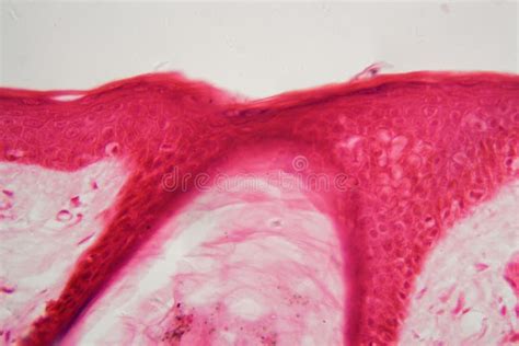 Skin with Follicle Under the Microscope Stock Photo - Image of follicle ...