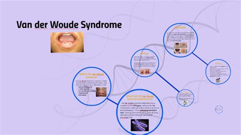 Van der Woude Syndrome by Jerald Whitley on Prezi