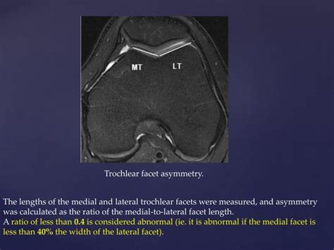 Patello femoral joint - MRI | PPT