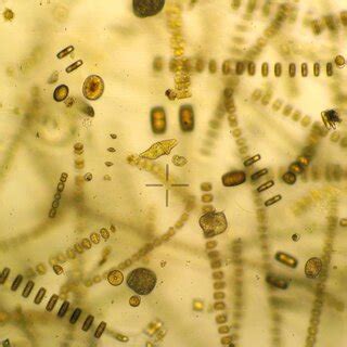 A look through the microscope at the natural phytoplankton community... | Download Scientific ...