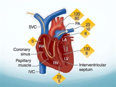 CVP Pulmonary artery wedge pressure monitoring: Physiology