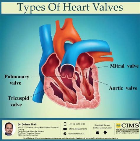 What are the names of heart valves? - Quora