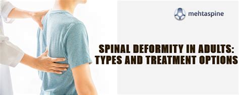 Spinal Deformity in Adults: Types and Treatment Options