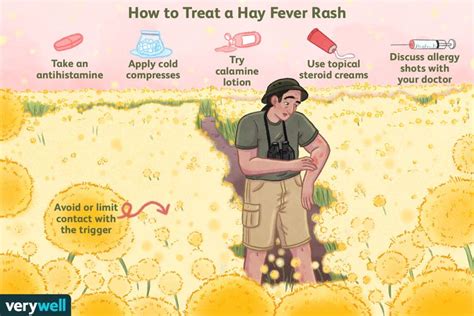 Hay Fever Rash Symptoms and Treatment