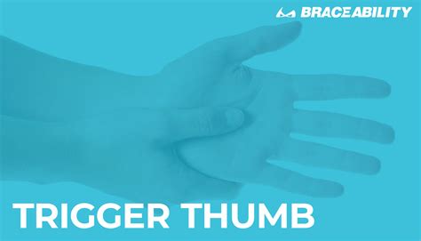 Trigger Finger Thumb Treatment | Symptoms, Causes, Surgery & Exercises