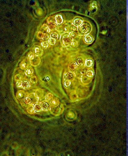 Microcystis aeruginosa cell