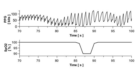 Trace of photoplethysmograph waveform (top) and blood oxygen saturation ...