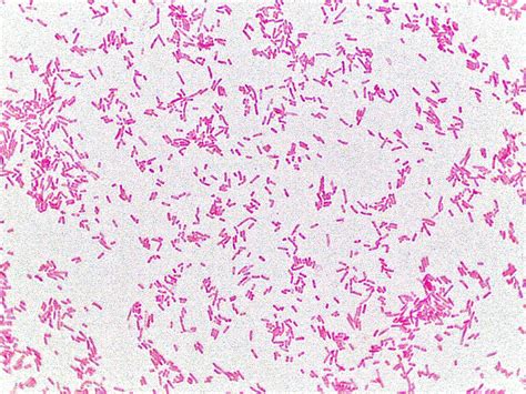 Pin on Escherichia coli Gram stain
